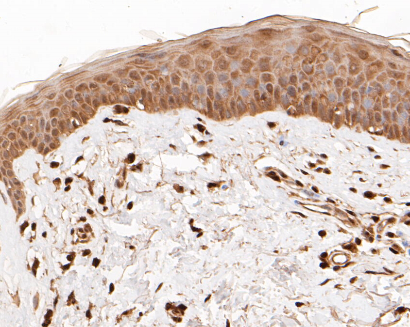 Immunohistochemical analysis of paraffin-embedded human skin tissue using anti-FoxP1 antibody. The section was pre-treated using heat mediated antigen retrieval with sodium citrate buffer (pH 6.0) for 20 minutes. The tissues were blocked in 5% BSA for 30 minutes at room temperature, washed with ddH2O and PBS, and then probed with the primary antibody (ER1901-25, 1/50)  for 30 minutes at room temperature. The detection was performed using an HRP conjugated compact polymer system. DAB was used as the chromogen. Tissues were counterstained with hematoxylin and mounted with DPX.