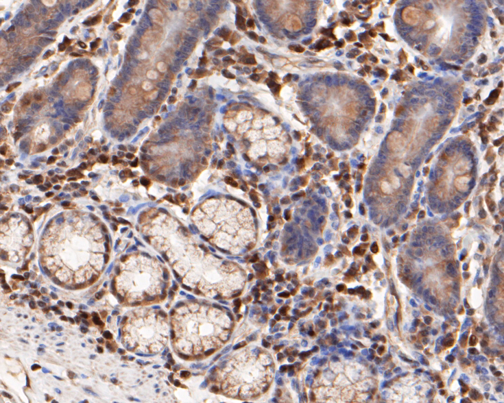 Immunohistochemical analysis of paraffin-embedded human small intestine tissue using anti-FoxP1 antibody. The section was pre-treated using heat mediated antigen retrieval with sodium citrate buffer (pH 6.0) for 20 minutes. The tissues were blocked in 5% BSA for 30 minutes at room temperature, washed with ddH2O and PBS, and then probed with the primary antibody (ER1901-25, 1/50)  for 30 minutes at room temperature. The detection was performed using an HRP conjugated compact polymer system. DAB was used as the chromogen. Tissues were counterstained with hematoxylin and mounted with DPX.