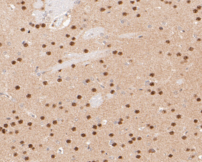 Immunohistochemical analysis of paraffin-embedded rat brain tissue using anti-FoxP1 antibody. The section was pre-treated using heat mediated antigen retrieval with sodium citrate buffer (pH 6.0) for 20 minutes. The tissues were blocked in 5% BSA for 30 minutes at room temperature, washed with ddH2O and PBS, and then probed with the primary antibody (ER1901-26, 1/50)  for 30 minutes at room temperature. The detection was performed using an HRP conjugated compact polymer system. DAB was used as the chromogen. Tissues were counterstained with hematoxylin and mounted with DPX.