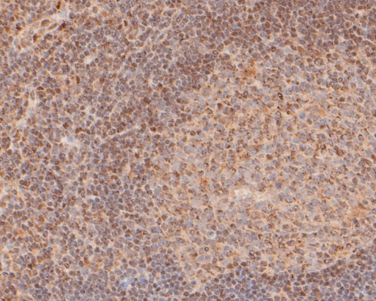 Immunohistochemical analysis of paraffin-embedded human tonsil tissue using anti-FoxP1 antibody. The section was pre-treated using heat mediated antigen retrieval with sodium citrate buffer (pH 6.0) for 20 minutes. The tissues were blocked in 5% BSA for 30 minutes at room temperature, washed with ddH2O and PBS, and then probed with the primary antibody (ER1901-26, 1/200)  for 30 minutes at room temperature. The detection was performed using an HRP conjugated compact polymer system. DAB was used as the chromogen. Tissues were counterstained with hematoxylin and mounted with DPX.