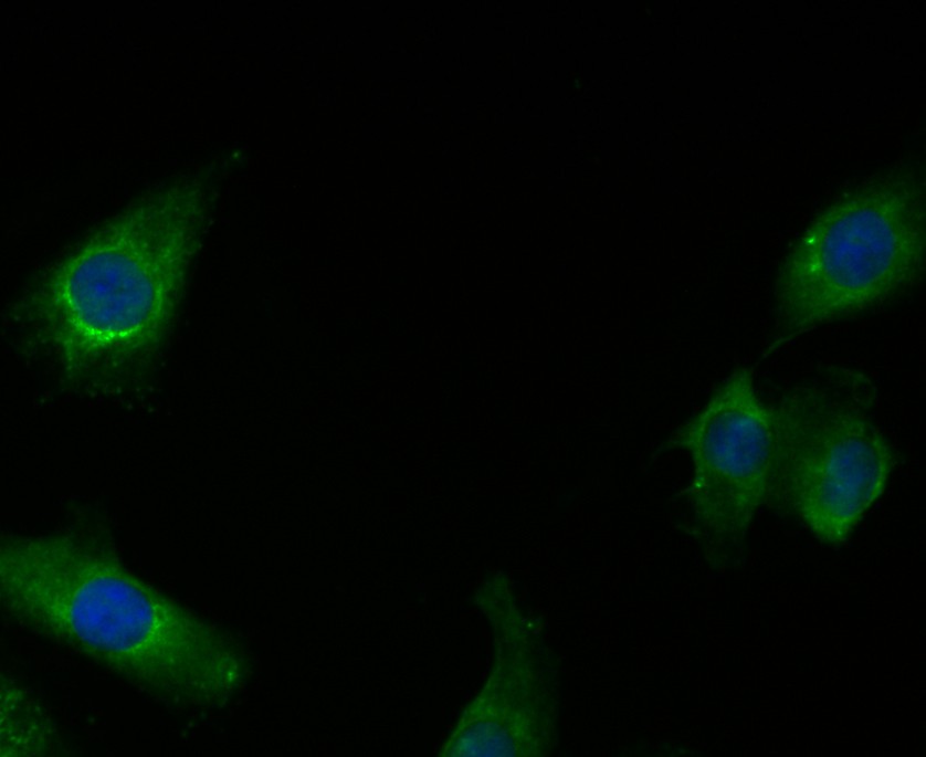ICC staining of RIP3 in A549 cells (green). Formalin fixed cells were permeabilized with 0.1% Triton X-100 in TBS for 10 minutes at room temperature and blocked with 1% Blocker BSA for 15 minutes at room temperature. Cells were probed with the antibody (ER1901-27) at a dilution of 1:200 for 1 hour at room temperature, washed with PBS. Alexa Fluor®488 Goat anti-Rabbit IgG was used as the secondary antibody at 1/100 dilution. The nuclear counter stain is DAPI (blue).