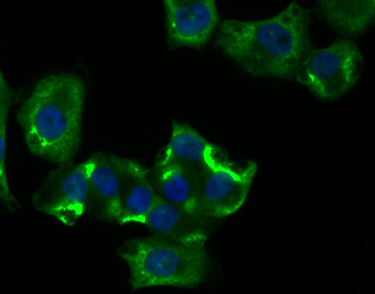 ICC staining of RIP3 in PANC-1 cells (green). Formalin fixed cells were permeabilized with 0.1% Triton X-100 in TBS for 10 minutes at room temperature and blocked with 1% Blocker BSA for 15 minutes at room temperature. Cells were probed with the antibody (ER1901-27) at a dilution of 1:100 for 1 hour at room temperature, washed with PBS. Alexa Fluor®488 Goat anti-Rabbit IgG was used as the secondary antibody at 1/100 dilution. The nuclear counter stain is DAPI (blue).