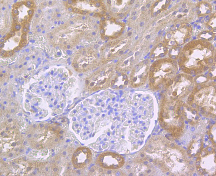 Immunohistochemical analysis of paraffin-embedded rat kidney tissue using anti-RIP3 antibody. The section was pre-treated using heat mediated antigen retrieval with Tris-EDTA buffer (pH 8.0-8.4) for 20 minutes.The tissues were blocked in 5% BSA for 30 minutes at room temperature, washed with ddH2O and PBS, and then probed with the antibody (ER1901-27) at 1/50 dilution, for 30 minutes at room temperature and detected using an HRP conjugated compact polymer system. DAB was used as the chromogen. Counter stained with hematoxylin and mounted with DPX.