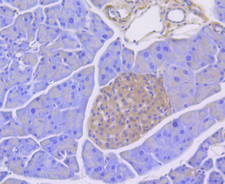 Immunohistochemical analysis of paraffin-embedded mouse pancreas tissue using anti-RIP3 antibody. The section was pre-treated using heat mediated antigen retrieval with Tris-EDTA buffer (pH 8.0-8.4) for 20 minutes.The tissues were blocked in 5% BSA for 30 minutes at room temperature, washed with ddH2O and PBS, and then probed with the antibody (ER1901-27) at 1/50 dilution, for 30 minutes at room temperature and detected using an HRP conjugated compact polymer system. DAB was used as the chromogen. Counter stained with hematoxylin and mounted with DPX.