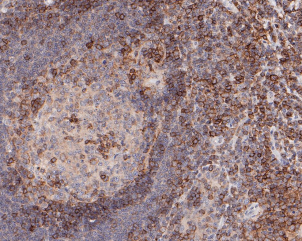 Immunohistochemical analysis of paraffin-embedded human tonsil tissue using anti-CD43 antibody. The section was pre-treated using heat mediated antigen retrieval with sodium citrate buffer (pH 6.0) for 20 minutes. The tissues were blocked in 5% BSA for 30 minutes at room temperature, washed with ddH2O and PBS, and then probed with the primary antibody (ER1901-28, 1/100)  for 30 minutes at room temperature. The detection was performed using an HRP conjugated compact polymer system. DAB was used as the chromogen. Tissues were counterstained with hematoxylin and mounted with DPX.