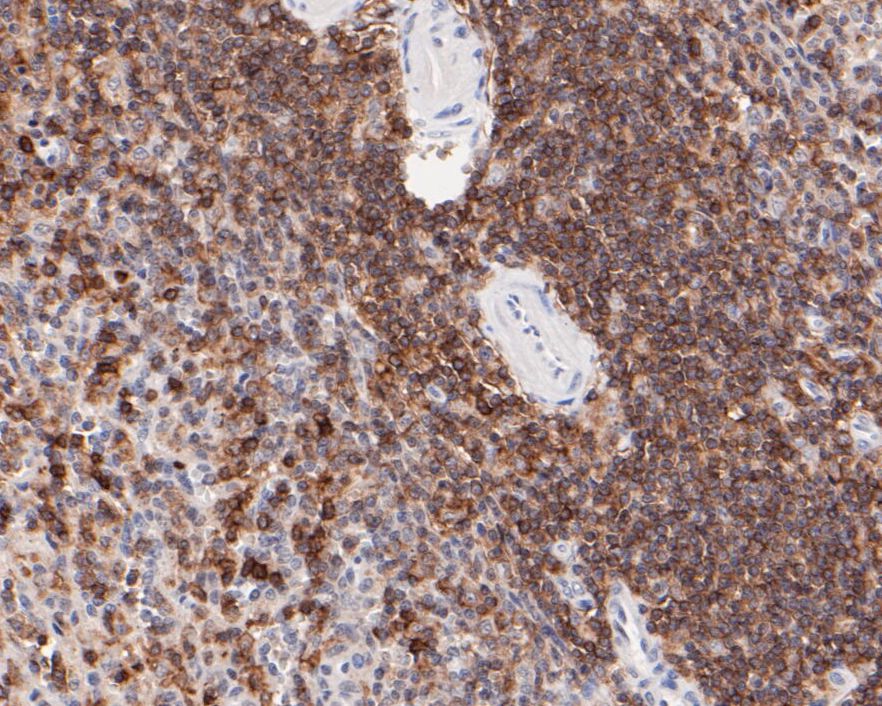 Immunohistochemical analysis of paraffin-embedded human spleen tissue using anti-CD43 antibody. The section was pre-treated using heat mediated antigen retrieval with sodium citrate buffer (pH 6.0) for 20 minutes. The tissues were blocked in 5% BSA for 30 minutes at room temperature, washed with ddH2O and PBS, and then probed with the primary antibody (ER1901-28, 1/100)  for 30 minutes at room temperature. The detection was performed using an HRP conjugated compact polymer system. DAB was used as the chromogen. Tissues were counterstained with hematoxylin and mounted with DPX.