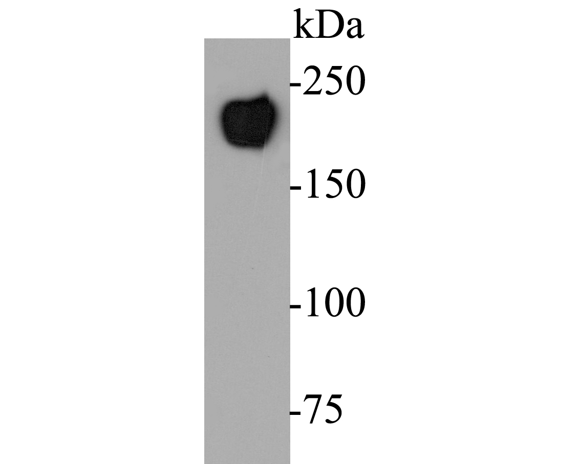 Western blot analysis of CD45 on Jurkat cell lysate. Proteins were transferred to a PVDF membrane and blocked with 5% BSA in PBS for 1 hour at room temperature. The primary antibody (ER1901-29, 1/1000) was used in 5% BSA at room temperature for 2 hours. Goat Anti-Rabbit IgG - HRP Secondary Antibody (HA1001) at 1:5,000 dilution was used for 1 hour at room temperature.