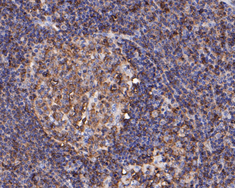 Immunohistochemical analysis of paraffin-embedded human tonsil tissue using anti-CD45 antibody. The section was pre-treated using heat mediated antigen retrieval with Tris-EDTA buffer (pH 8.0-8.4) for 20 minutes.The tissues were blocked in 5% BSA for 30 minutes at room temperature, washed with ddH2O and PBS, and then probed with the primary antibody (ER1901-29, 1/50) for 30 minutes at room temperature. The detection was performed using an HRP conjugated compact polymer system. DAB was used as the chromogen. Tissues were counterstained with hematoxylin and mounted with DPX.