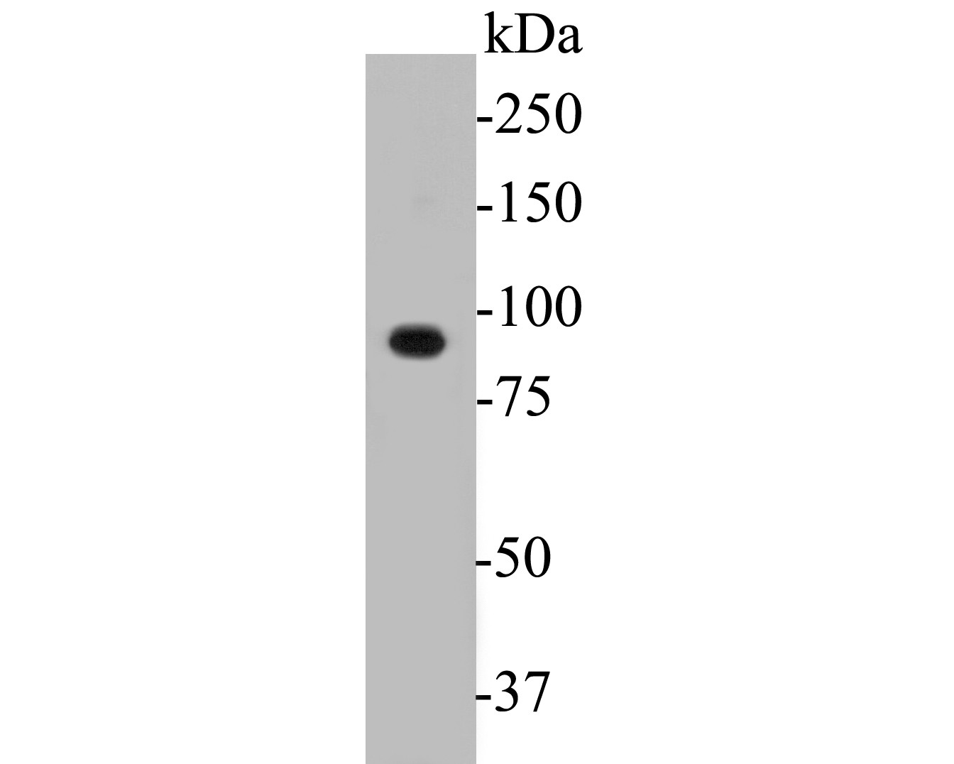 Western blot analysis of DOG1 on PC-3M cell lysates. Proteins were transferred to a PVDF membrane and blocked with 5% BSA in PBS for 1 hour at room temperature. The primary antibody (ER1901-30, 1/500) was used in 5% BSA at room temperature for 2 hours. Goat Anti-Rabbit IgG - HRP Secondary Antibody (HA1001) at 1:5,000 dilution was used for 1 hour at room temperature.