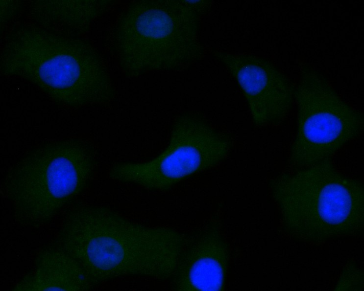 ICC staining of DOG1 in A549 cells (green). Formalin fixed cells were permeabilized with 0.1% Triton X-100 in TBS for 10 minutes at room temperature and blocked with 1% Blocker BSA for 15 minutes at room temperature. Cells were probed with the primary antibody (ER1901-30, 1/50) for 1 hour at room temperature, washed with PBS. Alexa Fluor®488 Goat anti-Rabbit IgG was used as the secondary antibody at 1/1,000 dilution. The nuclear counter stain is DAPI (blue).