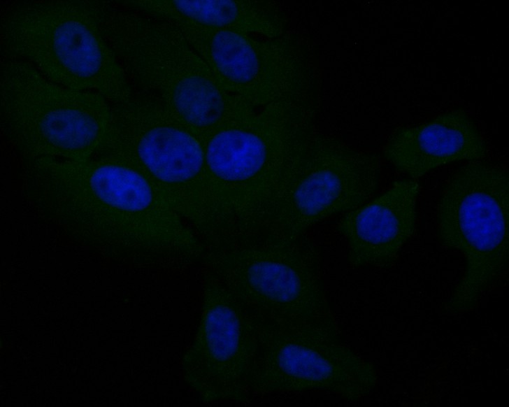 ICC staining of DOG1 in HepG2 cells (green). Formalin fixed cells were permeabilized with 0.1% Triton X-100 in TBS for 10 minutes at room temperature and blocked with 1% Blocker BSA for 15 minutes at room temperature. Cells were probed with the primary antibody (ER1901-30, 1/50) for 1 hour at room temperature, washed with PBS. Alexa Fluor®488 Goat anti-Rabbit IgG was used as the secondary antibody at 1/1,000 dilution. The nuclear counter stain is DAPI (blue).