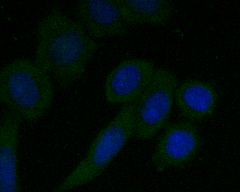 ICC staining of CD68 in SiHa cells (green). Formalin fixed cells were permeabilized with 0.1% Triton X-100 in TBS for 10 minutes at room temperature and blocked with 1% Blocker BSA for 15 minutes at room temperature. Cells were probed with the primary antibody (ER1901-32, 1/50) for 1 hour at room temperature, washed with PBS. Alexa Fluor®488 Goat anti-Rabbit IgG was used as the secondary antibody at 1/1,000 dilution. The nuclear counter stain is DAPI (blue).