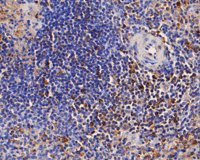 Immunohistochemical analysis of paraffin-embedded human spleen tissue using anti-CD68 antibody. The section was pre-treated using heat mediated antigen retrieval with Tris-EDTA buffer (pH 8.0-8.4) for 20 minutes.The tissues were blocked in 5% BSA for 30 minutes at room temperature, washed with ddH2O and PBS, and then probed with the primary antibody (ER1901-32, 1/50) for 30 minutes at room temperature. The detection was performed using an HRP conjugated compact polymer system. DAB was used as the chromogen. Tissues were counterstained with hematoxylin and mounted with DPX.