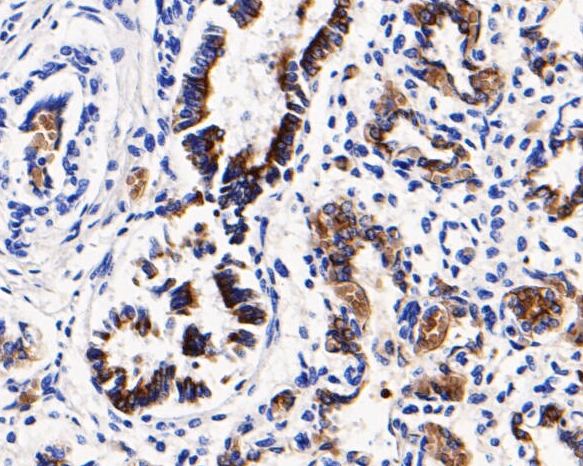 Immunohistochemical analysis of paraffin-embedded human lung tissue using anti-CD68 antibody. The section was pre-treated using heat mediated antigen retrieval with Tris-EDTA buffer (pH 8.0-8.4) for 20 minutes.The tissues were blocked in 5% BSA for 30 minutes at room temperature, washed with ddH2O and PBS, and then probed with the primary antibody (ER1901-32, 1/200) for 30 minutes at room temperature. The detection was performed using an HRP conjugated compact polymer system. DAB was used as the chromogen. Tissues were counterstained with hematoxylin and mounted with DPX.
