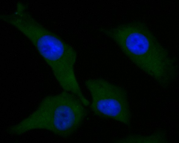 ICC staining of AKT3 in A549 cells (green). Formalin fixed cells were permeabilized with 0.1% Triton X-100 in TBS for 10 minutes at room temperature and blocked with 1% Blocker BSA for 15 minutes at room temperature. Cells were probed with the primary antibody (ER1901-33, 1/50) for 1 hour at room temperature, washed with PBS. Alexa Fluor®488 Goat anti-Rabbit IgG was used as the secondary antibody at 1/1,000 dilution. The nuclear counter stain is DAPI (blue).