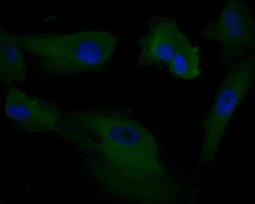 ICC staining of AKT3 in EA.hy926 cells (green). Formalin fixed cells were permeabilized with 0.1% Triton X-100 in TBS for 10 minutes at room temperature and blocked with 1% Blocker BSA for 15 minutes at room temperature. Cells were probed with the primary antibody (ER1901-33, 1/50) for 1 hour at room temperature, washed with PBS. Alexa Fluor®488 Goat anti-Rabbit IgG was used as the secondary antibody at 1/1,000 dilution. The nuclear counter stain is DAPI (blue).