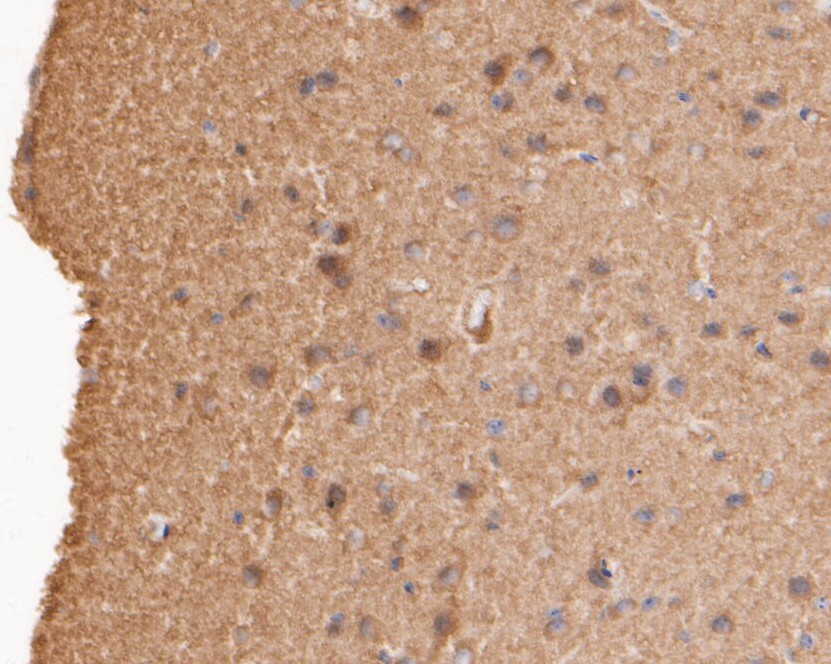 Immunohistochemical analysis of paraffin-embedded mouse brain tissue using anti-AKT3 antibody. The section was pre-treated using heat mediated antigen retrieval with sodium citrate buffer (pH 6.0) for 20 minutes. The tissues were blocked in 5% BSA for 30 minutes at room temperature, washed with ddH2O and PBS, and then probed with the primary antibody (ER1901-33, 1/200)  for 30 minutes at room temperature. The detection was performed using an HRP conjugated compact polymer system. DAB was used as the chromogen. Tissues were counterstained with hematoxylin and mounted with DPX.