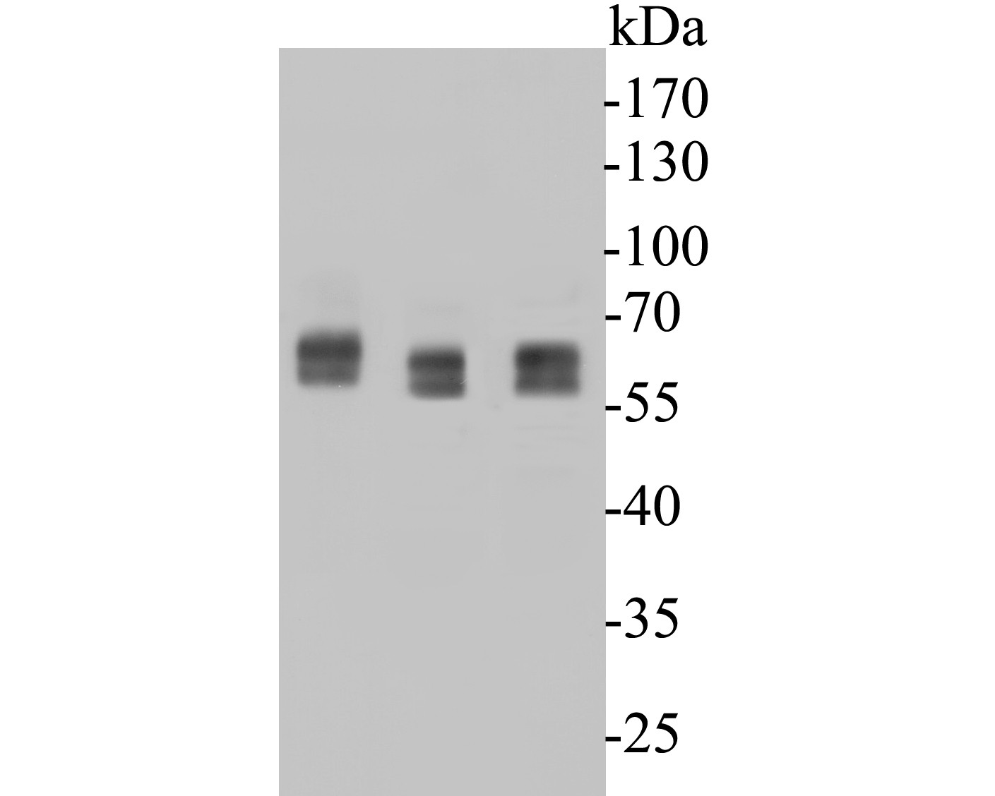 Western blot analysis of KCNAB1 on different lysates. Proteins were transferred to a PVDF membrane and blocked with 5% BSA in PBS for 1 hour at room temperature. The primary antibody (ER1901-34, 1/500) was used in 5% BSA at room temperature for 2 hours. Goat Anti-Rabbit IgG - HRP Secondary Antibody (HA1001) at 1:200,000 dilution was used for 1 hour at room temperature.<br />
Positive control: <br />
Lane 1: Mouse brain tissue lysates<br />
Lane 2: Rat brain tissue lysates<br />
Lane 3: Rat cerebellum tissue lysates