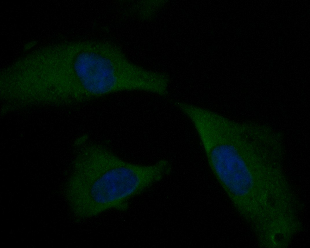 ICC staining of KCNAB1 in EA.hy926 cells (green). Formalin fixed cells were permeabilized with 0.1% Triton X-100 in TBS for 10 minutes at room temperature and blocked with 10% negative goat serum for 15 minutes at room temperature. Cells were probed with the primary antibody (ER1901-34, 1/50) for 1 hour at room temperature, washed with PBS. Alexa Fluor®488 Goat anti-Rabbit IgG was used as the secondary antibody at 1/1,000 dilution. The nuclear counter stain is DAPI (blue).