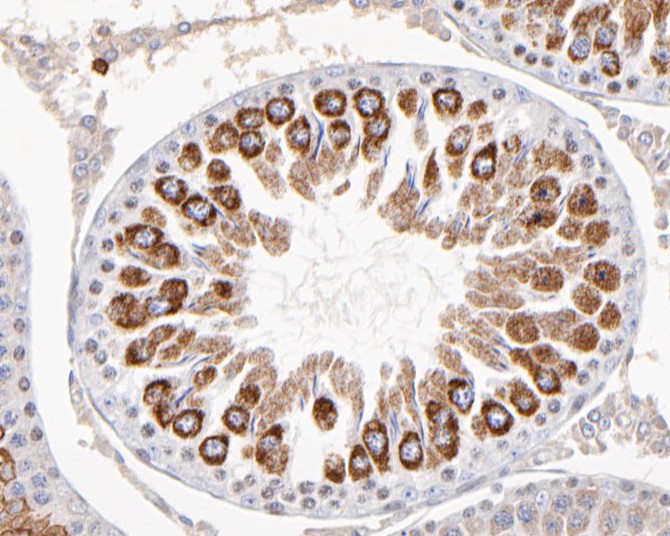 Immunohistochemical analysis of paraffin-embedded rat testis tissue using anti-KCNAB1 antibody. The section was pre-treated using heat mediated antigen retrieval with Tris-EDTA buffer (pH 9.0) for 20 minutes.The tissues were blocked in 5% BSA for 30 minutes at room temperature, washed with ddH2O and PBS, and then probed with the primary antibody (ER1901-34, 1/200) for 30 minutes at room temperature. The detection was performed using an HRP conjugated compact polymer system. DAB was used as the chromogen. Tissues were counterstained with hematoxylin and mounted with DPX.
