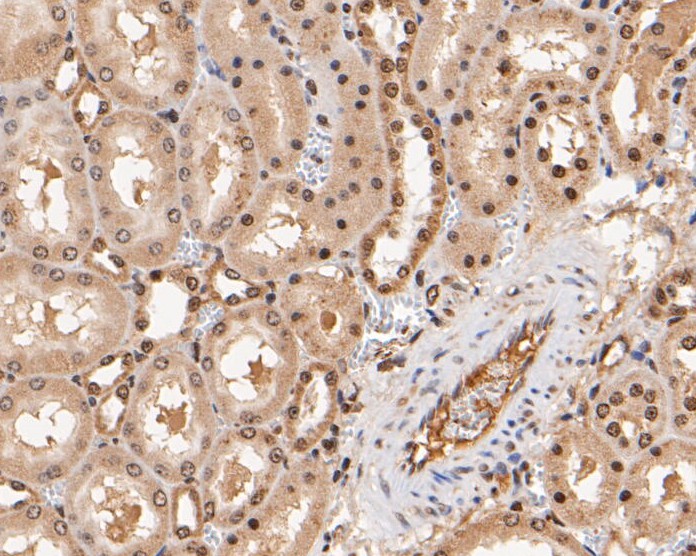 Immunohistochemical analysis of paraffin-embedded rat kidney tissue using anti-KCNAB1 antibody. The section was pre-treated using heat mediated antigen retrieval with Tris-EDTA buffer (pH 9.0) for 20 minutes.The tissues were blocked in 5% BSA for 30 minutes at room temperature, washed with ddH2O and PBS, and then probed with the primary antibody (ER1901-34, 1/200) for 30 minutes at room temperature. The detection was performed using an HRP conjugated compact polymer system. DAB was used as the chromogen. Tissues were counterstained with hematoxylin and mounted with DPX.