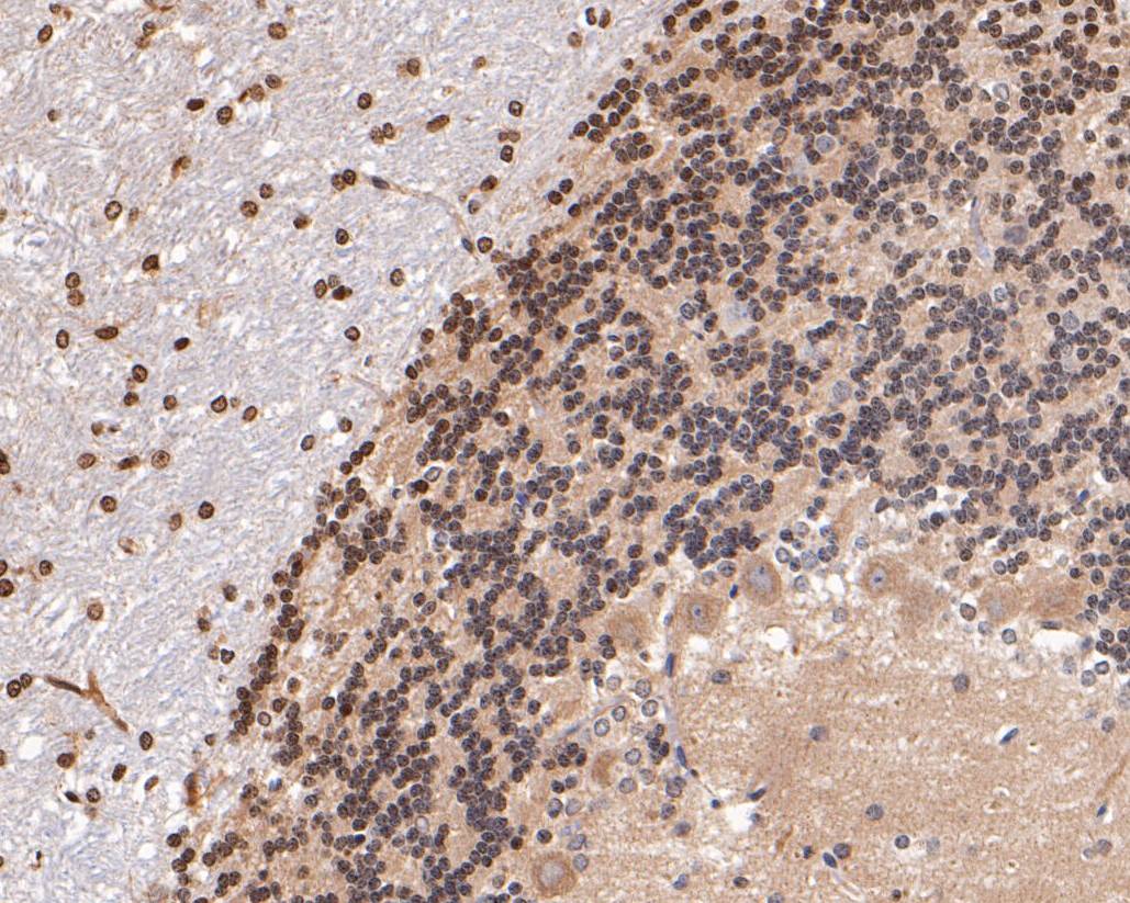 Immunohistochemical analysis of paraffin-embedded rat cerebellum tissue using anti-KCNAB1 antibody. The section was pre-treated using heat mediated antigen retrieval with Tris-EDTA buffer (pH 9.0) for 20 minutes.The tissues were blocked in 5% BSA for 30 minutes at room temperature, washed with ddH2O and PBS, and then probed with the primary antibody (ER1901-34, 1/200) for 30 minutes at room temperature. The detection was performed using an HRP conjugated compact polymer system. DAB was used as the chromogen. Tissues were counterstained with hematoxylin and mounted with DPX.