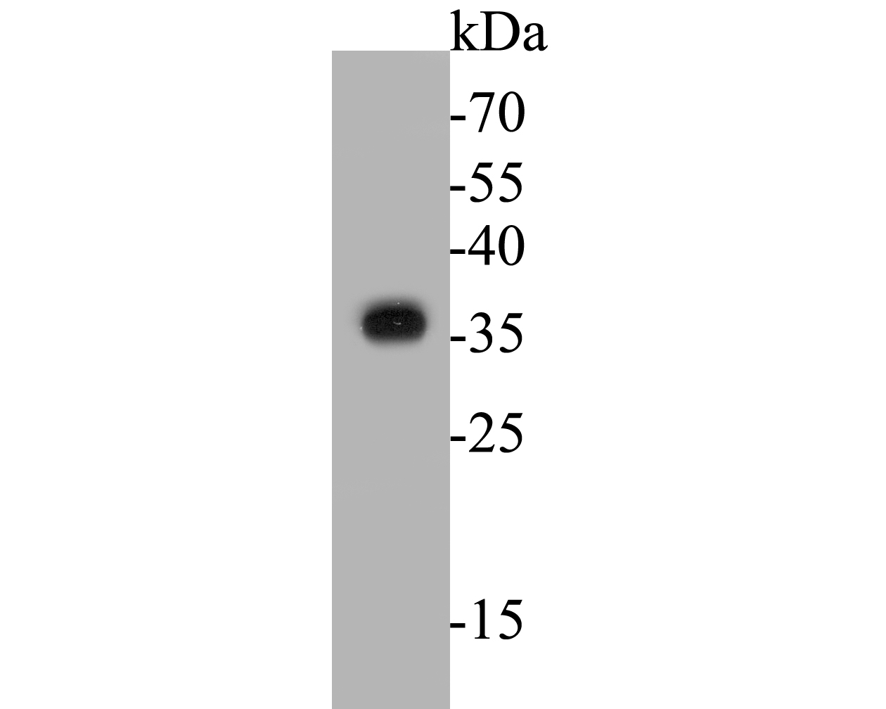 Western blot analysis of TMX1 on Daudi cell lysates. Proteins were transferred to a PVDF membrane and blocked with 5% BSA in PBS for 1 hour at room temperature. The primary antibody (ER1901-36, 1/500) was used in 5% BSA at room temperature for 2 hours. Goat Anti-Rabbit IgG - HRP Secondary Antibody (HA1001) at 1:5,000 dilution was used for 1 hour at room temperature.