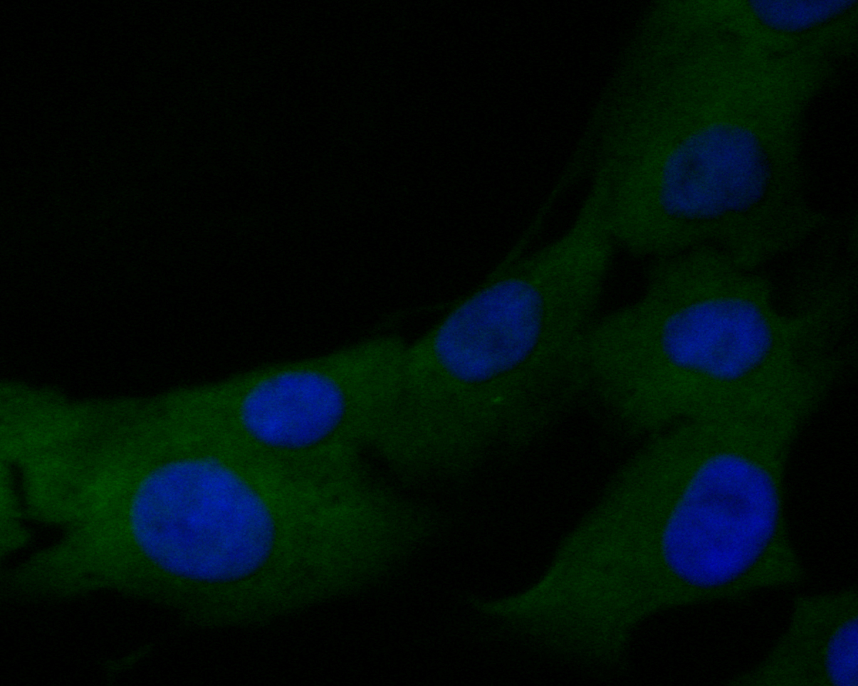 ICC staining of TMX1 in MG-63 cells (green). Formalin fixed cells were permeabilized with 0.1% Triton X-100 in TBS for 10 minutes at room temperature and blocked with 1% Blocker BSA for 15 minutes at room temperature. Cells were probed with the primary antibody (ER1901-36, 1/50) for 1 hour at room temperature, washed with PBS. Alexa Fluor®488 Goat anti-Rabbit IgG was used as the secondary antibody at 1/1,000 dilution. The nuclear counter stain is DAPI (blue).