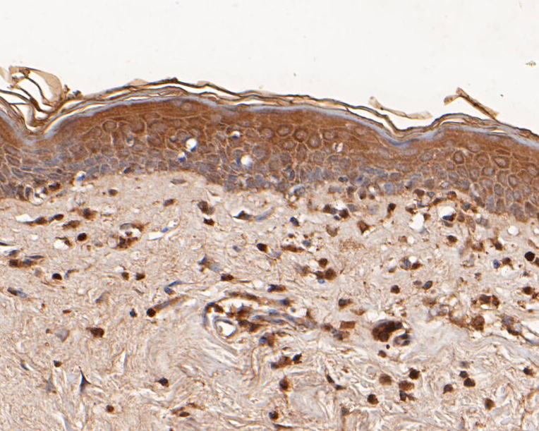 Immunohistochemical analysis of paraffin-embedded human skin tissue using anti-TMX1 antibody. The section was pre-treated using heat mediated antigen retrieval with Tris-EDTA buffer (pH 8.0-8.4) for 20 minutes.The tissues were blocked in 5% BSA for 30 minutes at room temperature, washed with ddH2O and PBS, and then probed with the primary antibody (ER1901-36, 1/50) for 30 minutes at room temperature. The detection was performed using an HRP conjugated compact polymer system. DAB was used as the chromogen. Tissues were counterstained with hematoxylin and mounted with DPX.