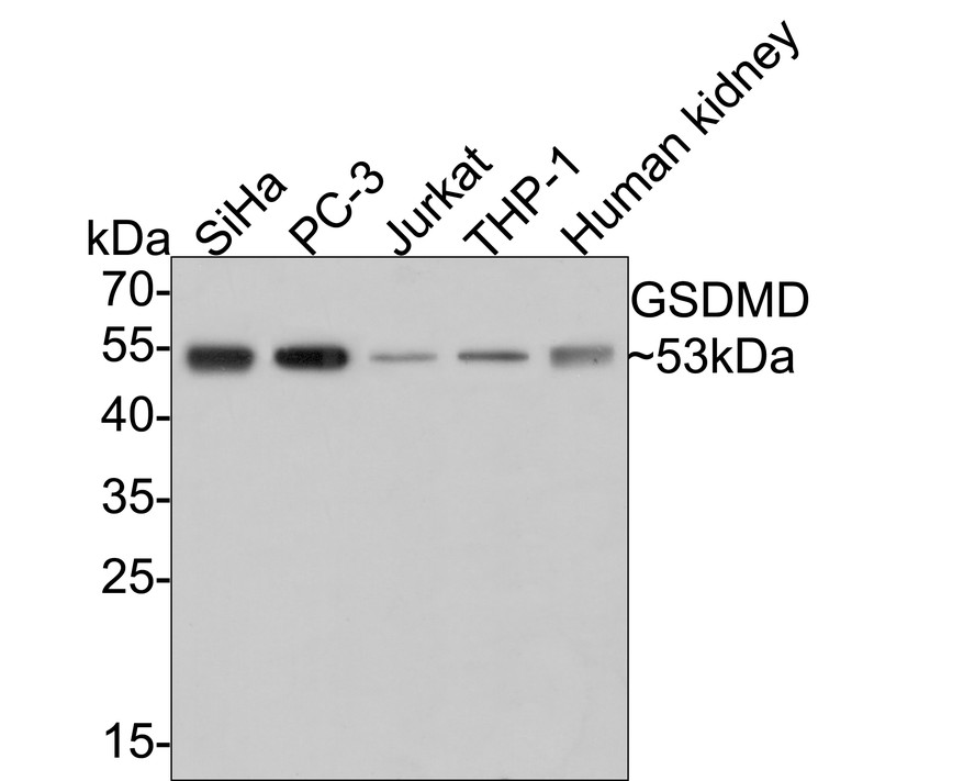 Western blot analysis of Gasdermin D (N terminal) on different lysates with Rabbit anti-Gasdermin D (N terminal) antibody (ER1901-37) at 1/1,000 dilution.<br />
<br />
Lane 1: SiHa cell lysate (10 µg/Lane)<br />
Lane 2: PC-3 cell lysate (10 µg/Lane)<br />
Lane 3: Jurkat cell lysate (10 µg/Lane)<br />
Lane 4: THP-1 cell lysate (10 µg/Lane)<br />
Lane 5: Human kidney tissue lysate (20 µg/Lane)<br />
<br />
Predicted band size: 53 kDa<br />
Observed band size: 53 kDa<br />
<br />
Exposure time: 2 minutes;<br />
<br />
12% SDS-PAGE gel.<br />
<br />
Proteins were transferred to a PVDF membrane and blocked with 5% NFDM/TBST for 1 hour at room temperature. The primary antibody (ER1901-37) at 1/1,000 dilution was used in 5% NFDM/TBST at room temperature for 2 hours. Goat Anti-Rabbit IgG - HRP Secondary Antibody (HA1001) at 1:300,000 dilution was used for 1 hour at room temperature.