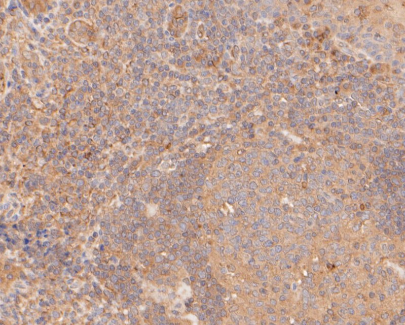 Immunohistochemical analysis of paraffin-embedded human tonsil tissue using anti-Gasdermin D (N terminal) antibody. The section was pre-treated using heat mediated antigen retrieval with sodium citrate buffer (pH 6.0) for 20 minutes. The tissues were blocked in 5% BSA for 30 minutes at room temperature, washed with ddH2O and PBS, and then probed with the primary antibody (ER1901-37, 1/50)  for 30 minutes at room temperature. The detection was performed using an HRP conjugated compact polymer system. DAB was used as the chromogen. Tissues were counterstained with hematoxylin and mounted with DPX.