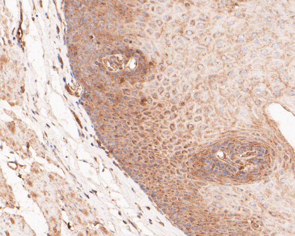 Immunohistochemical analysis of paraffin-embedded human esophagus tissue using anti-Gasdermin D (N terminal) antibody. The section was pre-treated using heat mediated antigen retrieval with sodium citrate buffer (pH 6.0) for 20 minutes. The tissues were blocked in 5% BSA for 30 minutes at room temperature, washed with ddH2O and PBS, and then probed with the primary antibody (ER1901-37, 1/200)  for 30 minutes at room temperature. The detection was performed using an HRP conjugated compact polymer system. DAB was used as the chromogen. Tissues were counterstained with hematoxylin and mounted with DPX.