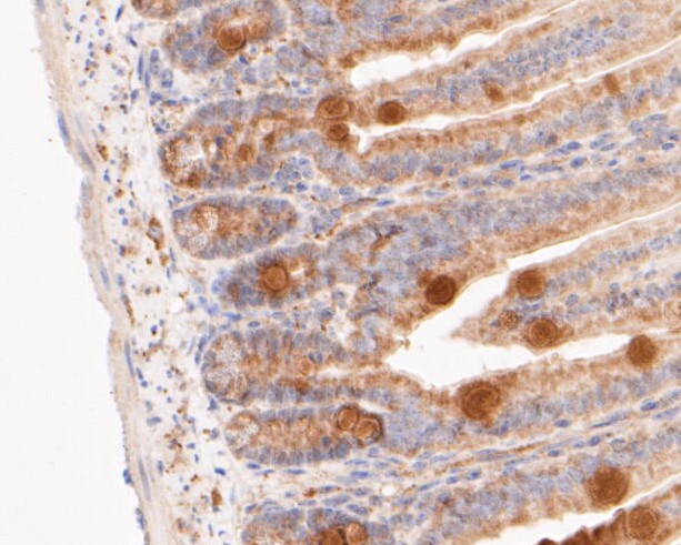 Immunohistochemical analysis of paraffin-embedded Mouse colon tissue using anti-Gasdermin D (N terminal) antibody. The section was pre-treated using heat mediated antigen retrieval with sodium citrate buffer (pH 6.0) for 20 minutes. The tissues were blocked in 5% BSA for 30 minutes at room temperature, washed with ddH2O and PBS, and then probed with the primary antibody (ER1901-37, 1/200)  for 30 minutes at room temperature. The detection was performed using an HRP conjugated compact polymer system. DAB was used as the chromogen. Tissues were counterstained with hematoxylin and mounted with DPX.