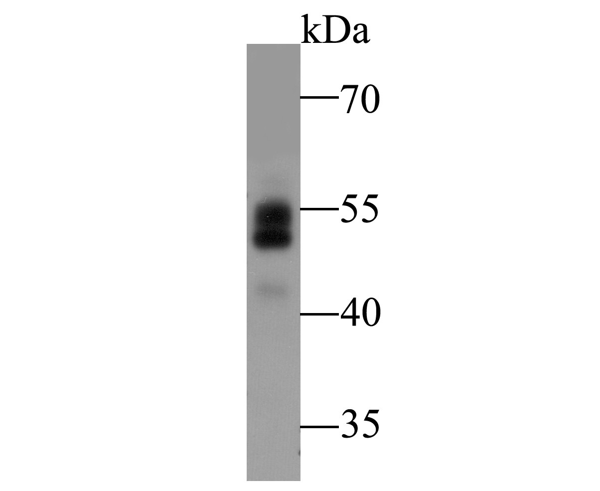 Western blot analysis of BIN1 on rat spleen tissue lysate. Proteins were transferred to a PVDF membrane and blocked with 5% BSA in PBS for 1 hour at room temperature. The primary antibody (ER1901-39, 1/500) was used in 5% BSA at room temperature for 2 hours. Goat Anti-Rabbit IgG - HRP Secondary Antibody (HA1001) at 1:5,000 dilution was used for 1 hour at room temperature.