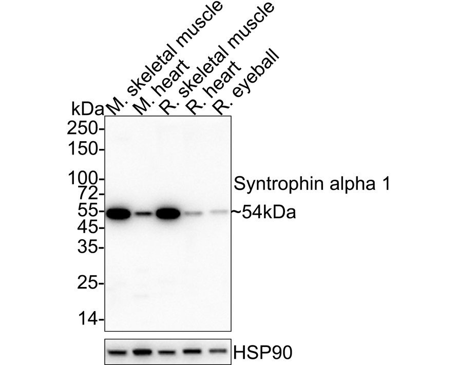 Western blot analysis of Syntrophin alpha 1 on different lysates. Proteins were transferred to a PVDF membrane and blocked with 5% BSA in PBS for 1 hour at room temperature. The primary antibody (ER1901-40, 1/500) was used in 5% BSA at room temperature for 2 hours. Goat Anti-Rabbit IgG - HRP Secondary Antibody (HA1001) at 1:5,000 dilution was used for 1 hour at room temperature.<br />
Positive control: <br />
Lane 1: Mouse skeletal muscle tissue lysate<br />
Lane 2: Rat skeletal muscle tissue lysate