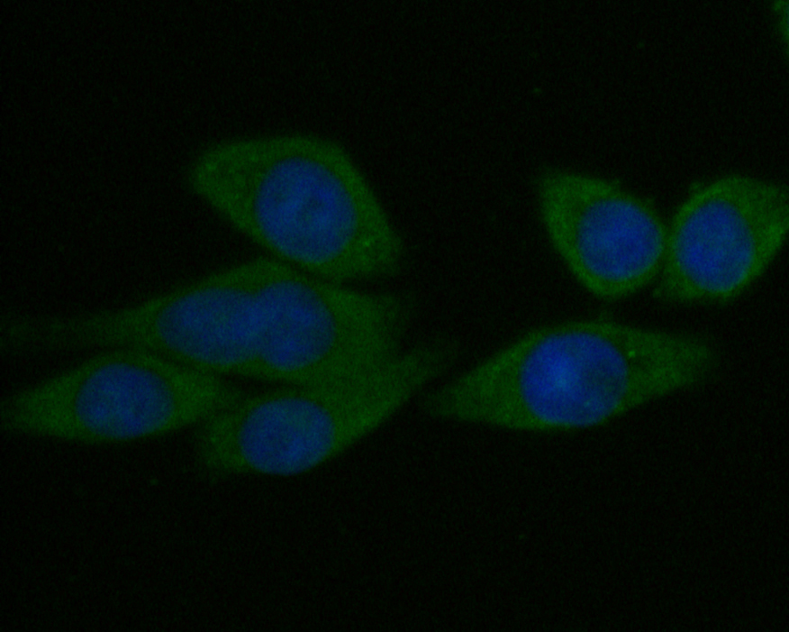 ICC staining of Syntrophin alpha 1 in SW620 cells (green). Formalin fixed cells were permeabilized with 0.1% Triton X-100 in TBS for 10 minutes at room temperature and blocked with 1% Blocker BSA for 15 minutes at room temperature. Cells were probed with the primary antibody (ER1901-40, 1/50) for 1 hour at room temperature, washed with PBS. Alexa Fluor®488 Goat anti-Rabbit IgG was used as the secondary antibody at 1/1,000 dilution. The nuclear counter stain is DAPI (blue).