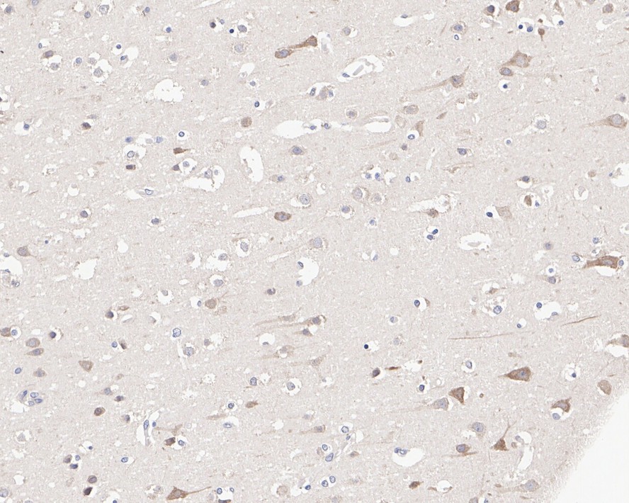 Immunohistochemical analysis of paraffin-embedded mouse brain tissue using anti-KCNB1 antibody. The section was pre-treated using heat mediated antigen retrieval with Tris-EDTA buffer (pH 8.0-8.4) for 20 minutes.The tissues were blocked in 5% BSA for 30 minutes at room temperature, washed with ddH2O and PBS, and then probed with the primary antibody (ER1901-41, 1/200) for 30 minutes at room temperature. The detection was performed using an HRP conjugated compact polymer system. DAB was used as the chromogen. Tissues were counterstained with hematoxylin and mounted with DPX.