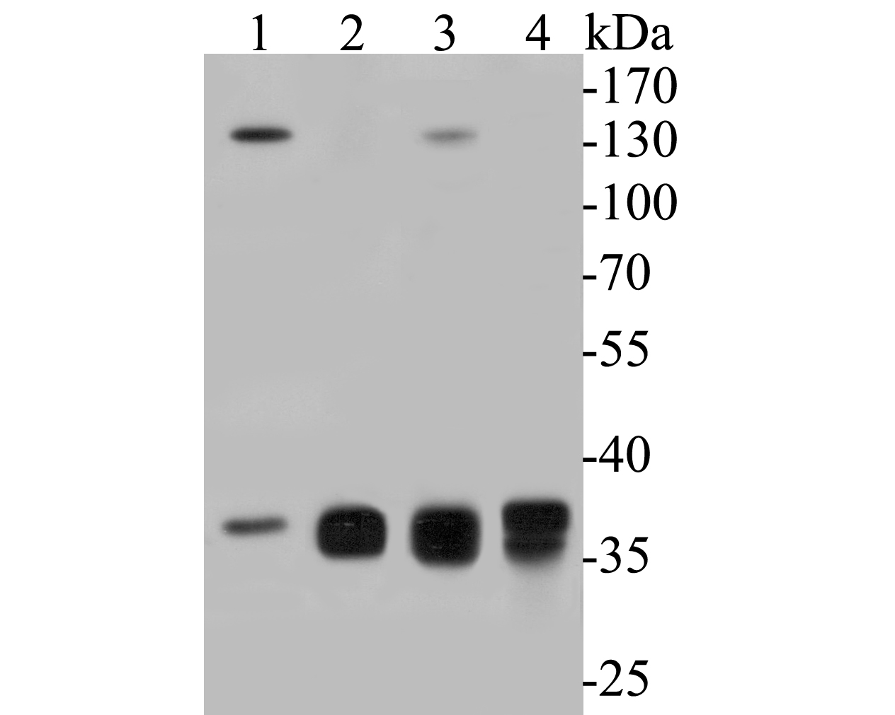 Western blot analysis of Aldolase B on different lysates. Proteins were transferred to a PVDF membrane and blocked with 5% BSA in PBS for 1 hour at room temperature. The primary antibody (ER1901-42, 1/500) was used in 5% BSA at room temperature for 2 hours. Goat Anti-Rabbit IgG - HRP Secondary Antibody (HA1001) at 1:5,000 dilution was used for 1 hour at room temperature.<br />
Positive control: <br />
Lane 1: SH-SY5Y cell lysate<br />
Lane 2: human liver tissue lysate<br />
Lane 3: mouse liver tissue lysate<br />
Lane 4: mouse kidney tissue lysate
