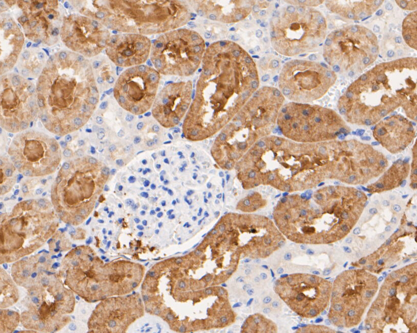 Immunohistochemical analysis of paraffin-embedded rat kidney tissue using anti-Aldolase B antibody. The section was pre-treated using heat mediated antigen retrieval with Tris-EDTA buffer (pH 8.0-8.4) for 20 minutes.The tissues were blocked in 5% BSA for 30 minutes at room temperature, washed with ddH2O and PBS, and then probed with the primary antibody (ER1901-42, 1/50) for 30 minutes at room temperature. The detection was performed using an HRP conjugated compact polymer system. DAB was used as the chromogen. Tissues were counterstained with hematoxylin and mounted with DPX.