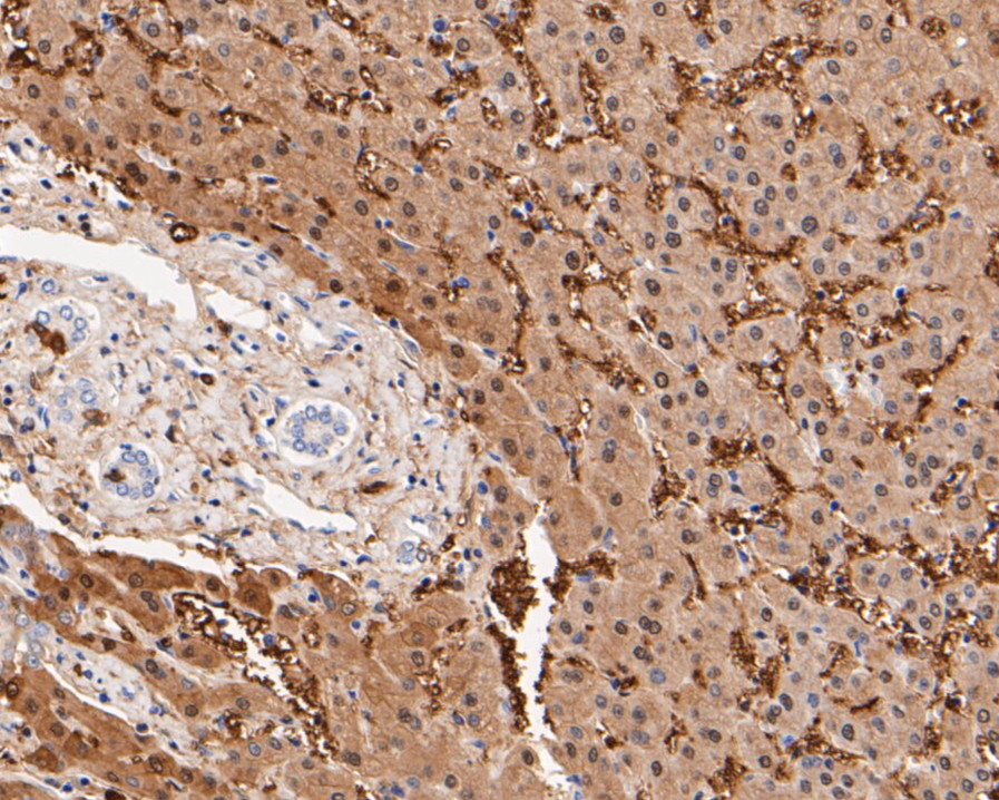 Immunohistochemical analysis of paraffin-embedded human liver tissue using anti-Aldolase B antibody. The section was pre-treated using heat mediated antigen retrieval with Tris-EDTA buffer (pH 8.0-8.4) for 20 minutes.The tissues were blocked in 5% BSA for 30 minutes at room temperature, washed with ddH2O and PBS, and then probed with the primary antibody (ER1901-42, 1/50) for 30 minutes at room temperature. The detection was performed using an HRP conjugated compact polymer system. DAB was used as the chromogen. Tissues were counterstained with hematoxylin and mounted with DPX.