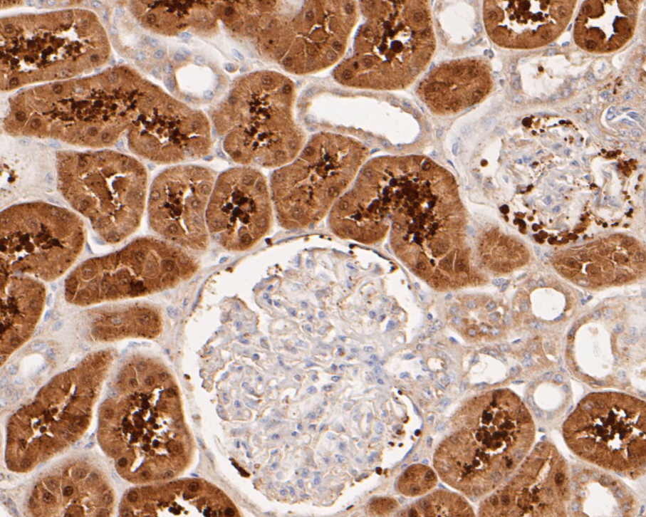 Immunohistochemical analysis of paraffin-embedded human kidney tissue using anti-Aldolase B antibody. The section was pre-treated using heat mediated antigen retrieval with Tris-EDTA buffer (pH 8.0-8.4) for 20 minutes.The tissues were blocked in 5% BSA for 30 minutes at room temperature, washed with ddH2O and PBS, and then probed with the primary antibody (ER1901-42, 1/50) for 30 minutes at room temperature. The detection was performed using an HRP conjugated compact polymer system. DAB was used as the chromogen. Tissues were counterstained with hematoxylin and mounted with DPX.