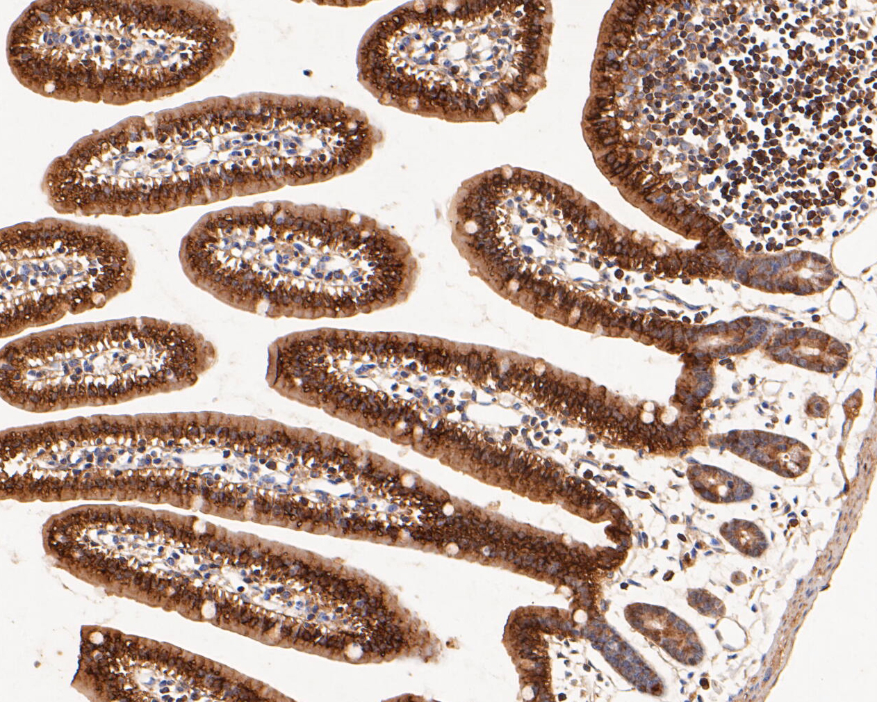 Immunohistochemical analysis of paraffin-embedded mouse small intestine tissue using anti-Aldolase B antibody. The section was pre-treated using heat mediated antigen retrieval with Tris-EDTA buffer (pH 8.0-8.4) for 20 minutes.The tissues were blocked in 5% BSA for 30 minutes at room temperature, washed with ddH2O and PBS, and then probed with the primary antibody (ER1901-42, 1/50) for 30 minutes at room temperature. The detection was performed using an HRP conjugated compact polymer system. DAB was used as the chromogen. Tissues were counterstained with hematoxylin and mounted with DPX.