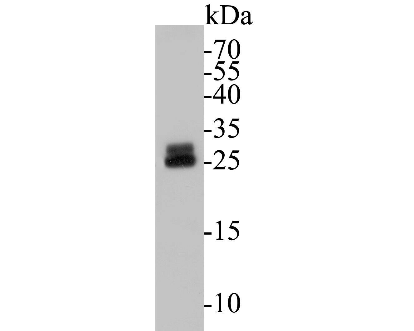 Western blot analysis of RBPMS on mouse lung tissue lysates. Proteins were transferred to a PVDF membrane and blocked with 5% BSA in PBS for 1 hour at room temperature. The primary antibody (ER1901-43, 1/500) was used in 5% BSA at room temperature for 2 hours. Goat Anti-Rabbit IgG - HRP Secondary Antibody (HA1001) at 1:5,000 dilution was used for 1 hour at room temperature.