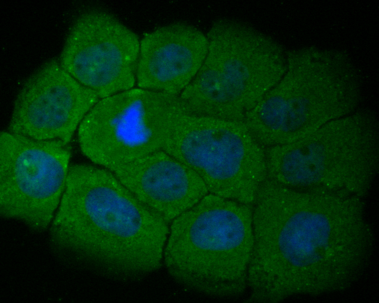 ICC staining of RBPMS in A431 cells (green). Formalin fixed cells were permeabilized with 0.1% Triton X-100 in TBS for 10 minutes at room temperature and blocked with 1% Blocker BSA for 15 minutes at room temperature. Cells were probed with the primary antibody (ER1901-43, 1/200) for 1 hour at room temperature, washed with PBS. Alexa Fluor®488 Goat anti-Rabbit IgG was used as the secondary antibody at 1/1,000 dilution. The nuclear counter stain is DAPI (blue).