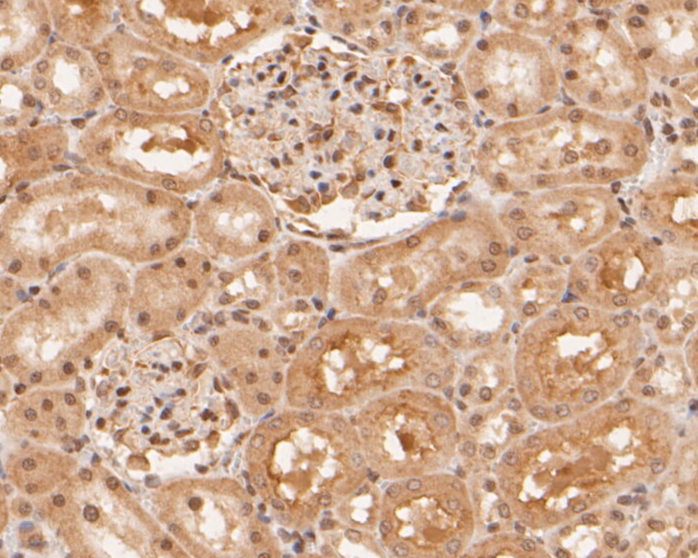 Immunohistochemical analysis of paraffin-embedded rat kidney tissue using anti-RBPMS antibody. The section was pre-treated using heat mediated antigen retrieval with sodium citrate buffer (pH 6.0) for 20 minutes. The tissues were blocked in 5% BSA for 30 minutes at room temperature, washed with ddH2O and PBS, and then probed with the primary antibody (ER1901-43, 1/50)  for 30 minutes at room temperature. The detection was performed using an HRP conjugated compact polymer system. DAB was used as the chromogen. Tissues were counterstained with hematoxylin and mounted with DPX.