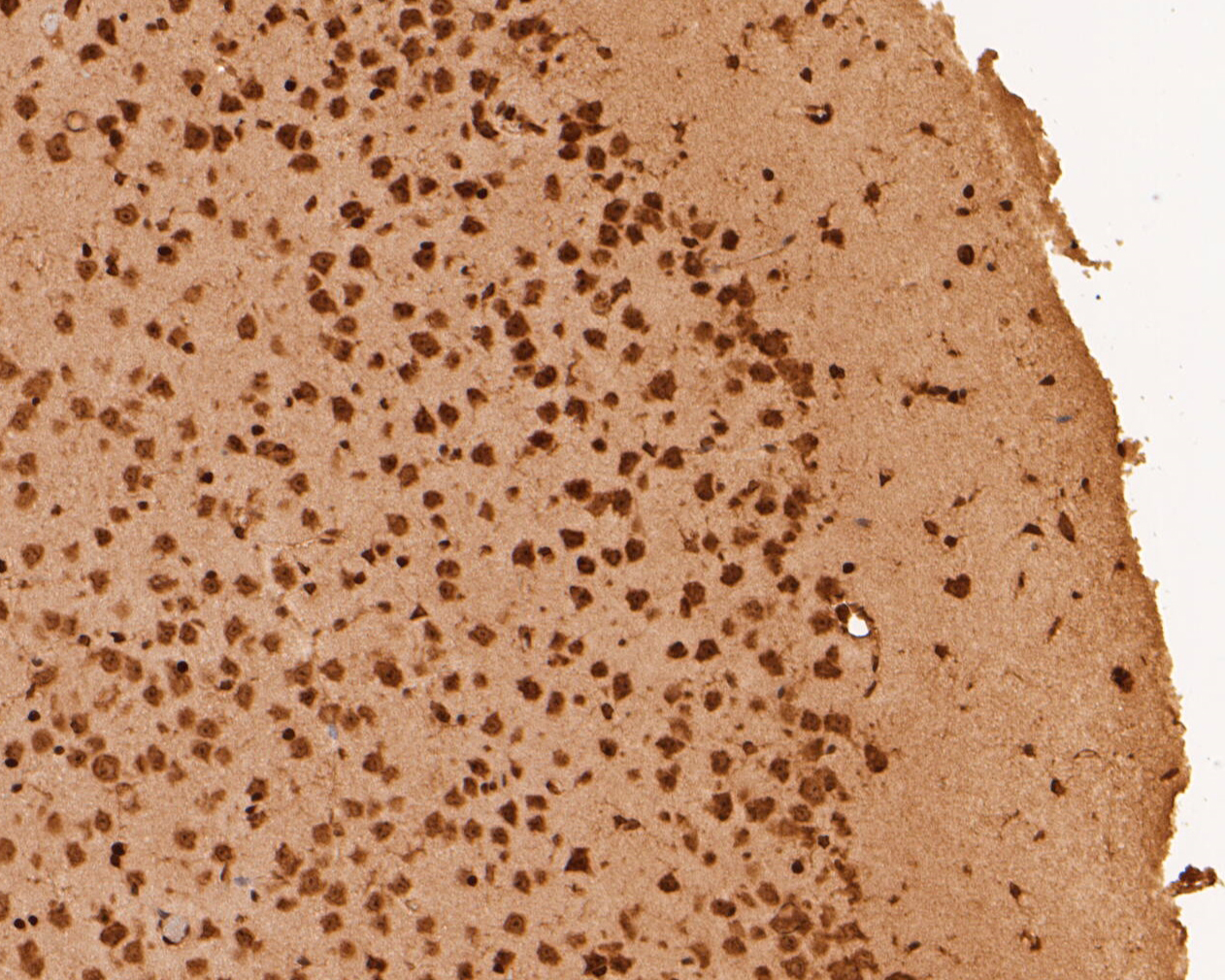 Immunohistochemical analysis of paraffin-embedded mouse brain tissue using anti-RBPMS antibody. The section was pre-treated using heat mediated antigen retrieval with sodium citrate buffer (pH 6.0) for 20 minutes. The tissues were blocked in 5% BSA for 30 minutes at room temperature, washed with ddH2O and PBS, and then probed with the primary antibody (ER1901-43, 1/50)  for 30 minutes at room temperature. The detection was performed using an HRP conjugated compact polymer system. DAB was used as the chromogen. Tissues were counterstained with hematoxylin and mounted with DPX.