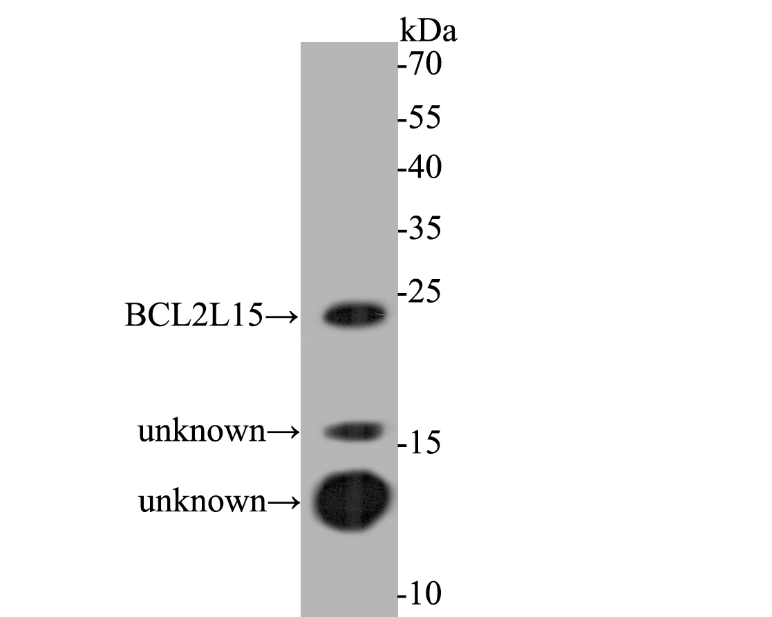 Western blot analysis of BCL2L15 on rat cecum tissue lysates. Proteins were transferred to a PVDF membrane and blocked with 5% BSA in PBS for 1 hour at room temperature. The primary antibody (ER1901-44, 1/500) was used in 5% BSA at room temperature for 2 hours. Goat Anti-Rabbit IgG - HRP Secondary Antibody (HA1001) at 1:5,000 dilution was used for 1 hour at room temperature.