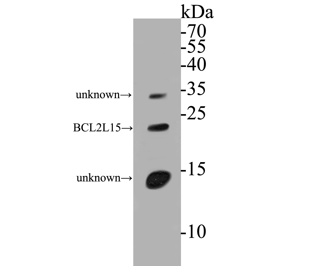 Western blot analysis of BCL2L15 on human small intestine tissue lysates. Proteins were transferred to a PVDF membrane and blocked with 5% BSA in PBS for 1 hour at room temperature. The primary antibody (ER1901-44, 1/500) was used in 5% BSA at room temperature for 2 hours. Goat Anti-Rabbit IgG - HRP Secondary Antibody (HA1001) at 1:5,000 dilution was used for 1 hour at room temperature.