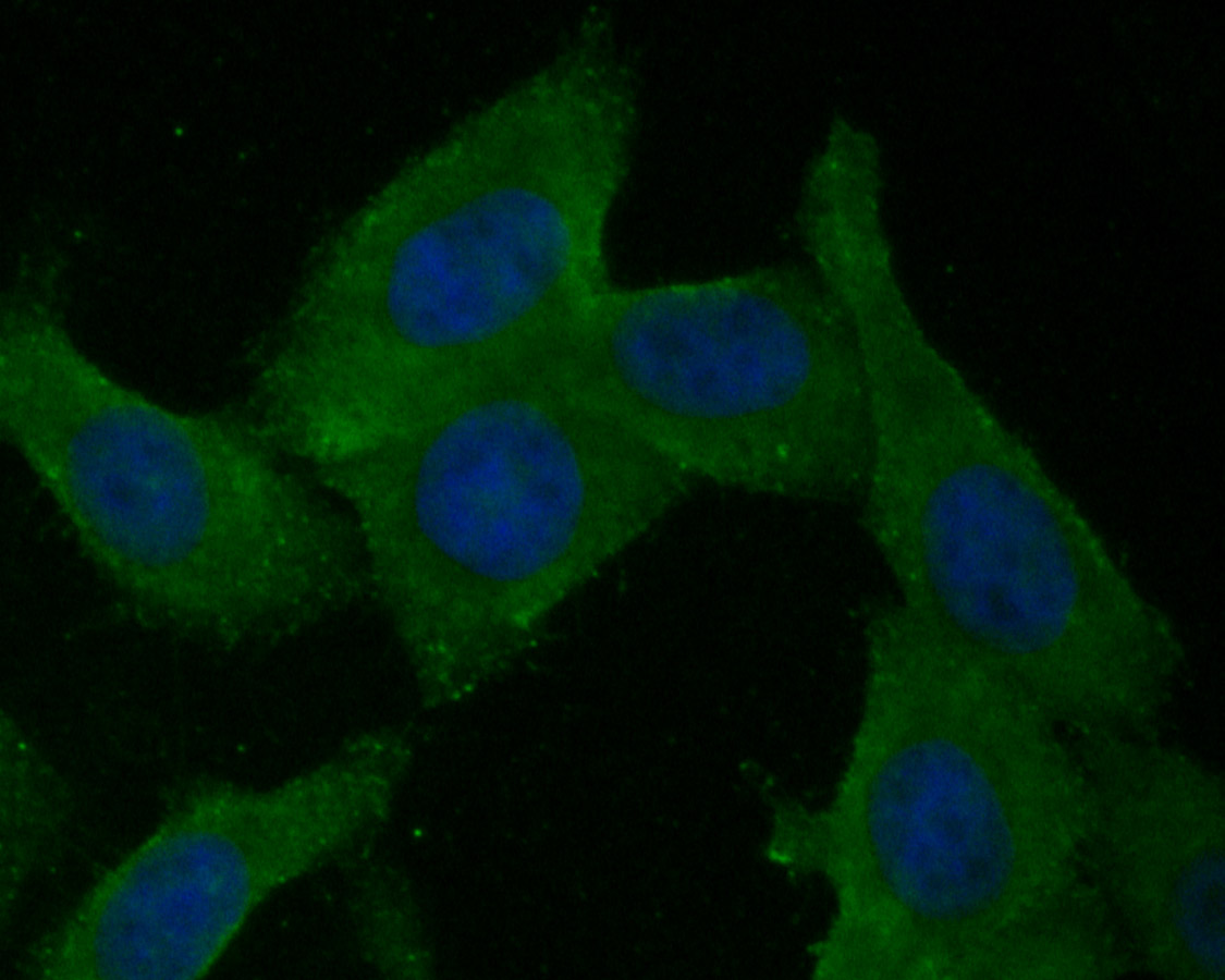 ICC staining of BCL2L15 in SKOV-3 cells (green). Formalin fixed cells were permeabilized with 0.1% Triton X-100 in TBS for 10 minutes at room temperature and blocked with 1% Blocker BSA for 15 minutes at room temperature. Cells were probed with the primary antibody (ER1901-44, 1/50) for 1 hour at room temperature, washed with PBS. Alexa Fluor®488 Goat anti-Rabbit IgG was used as the secondary antibody at 1/1,000 dilution. The nuclear counter stain is DAPI (blue).