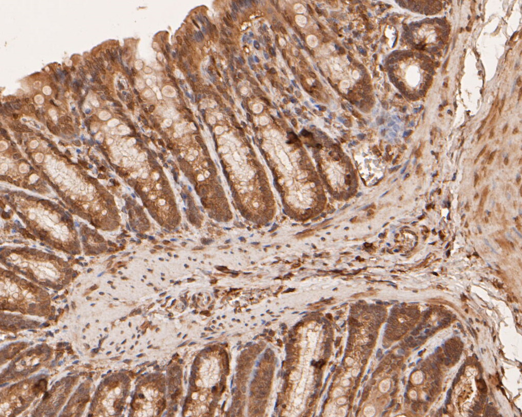Immunohistochemical analysis of paraffin-embedded rat large intestine tissue using anti-BCL2L15 antibody. The section was pre-treated using heat mediated antigen retrieval with sodium citrate buffer (pH 6.0) for 20 minutes. The tissues were blocked in 5% BSA for 30 minutes at room temperature, washed with ddH2O and PBS, and then probed with the primary antibody (ER1901-44, 1/50)  for 30 minutes at room temperature. The detection was performed using an HRP conjugated compact polymer system. DAB was used as the chromogen. Tissues were counterstained with hematoxylin and mounted with DPX.